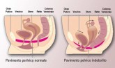 Esercizi per prepararsi al parto